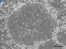 Feeder-free human iPS cells