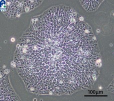 Human iPS cells with feeder cells