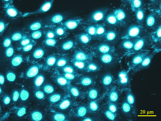 マイコプラズマに汚染されたVero細胞の蛍光染色画像